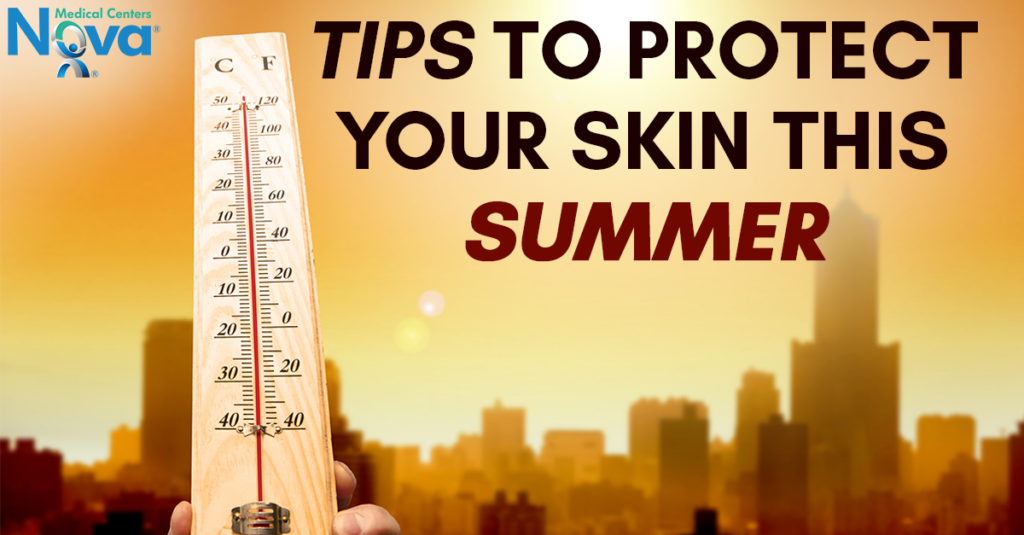 Step into Summer with these Sun Protection Tips