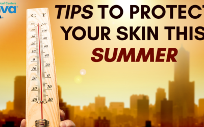 Tips to Protect Your Skin this Summer