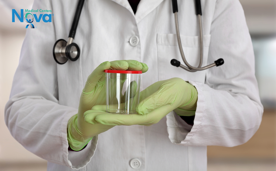 Doctor holding empty container for urine or sperm samples in hands